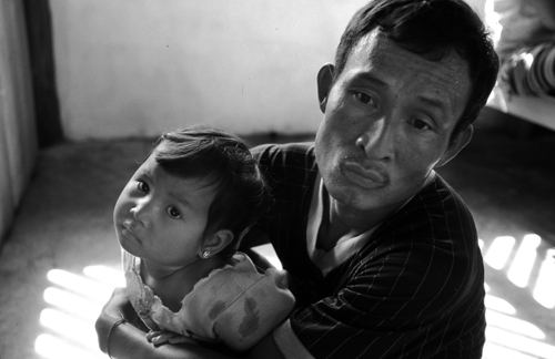 Le Per Her, a small IDP camp five hours drive north of Mae Sot. Held close by her father, this young girl is one of twenty-six children being tested for Malaria.